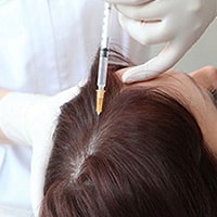 مزوتراپی مو چگونه انجام می شود؟